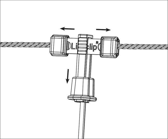 Litzclip Reparaturset f. Vertikalstreben